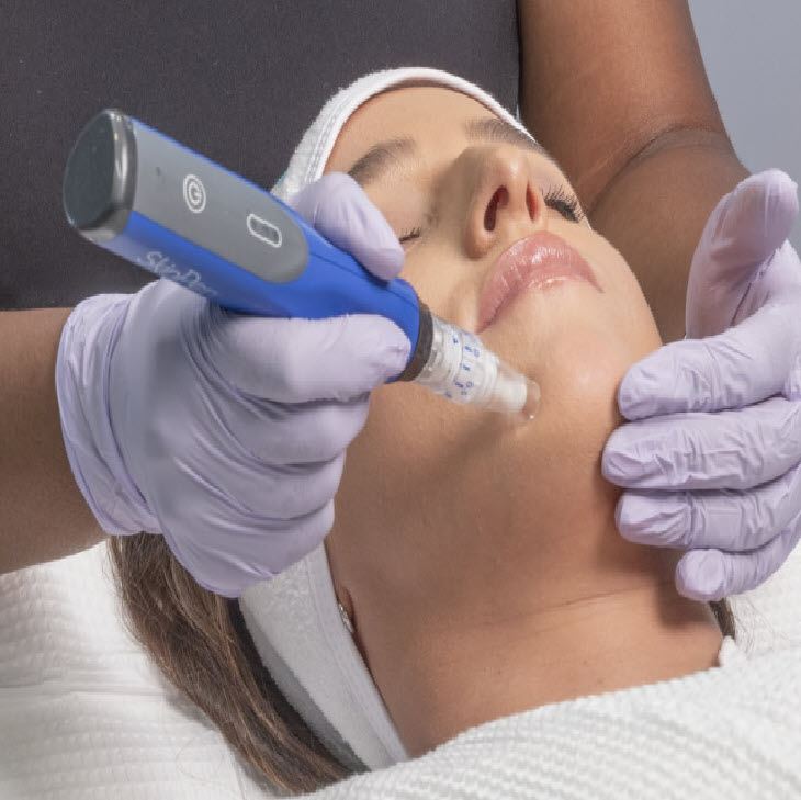 Micro needling w/Skin Pen